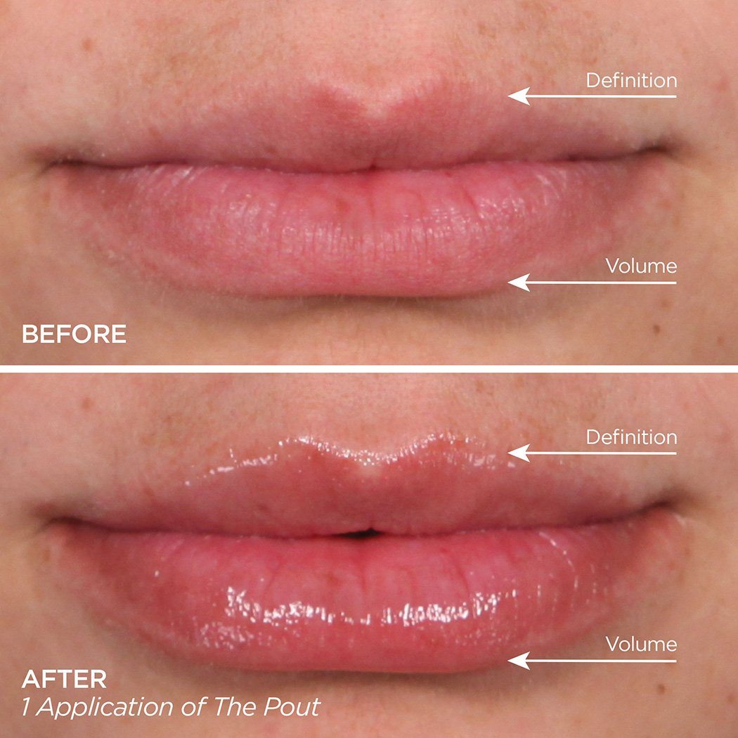 5-Star Faves Sets BeautyBio