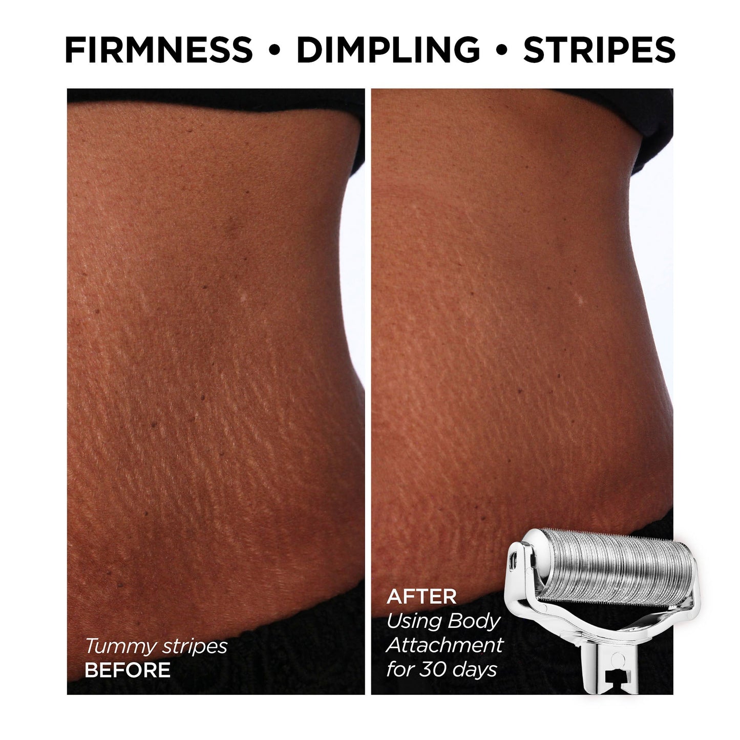 Head-to-toe AfterGLO Set GloPRO BeautyBio