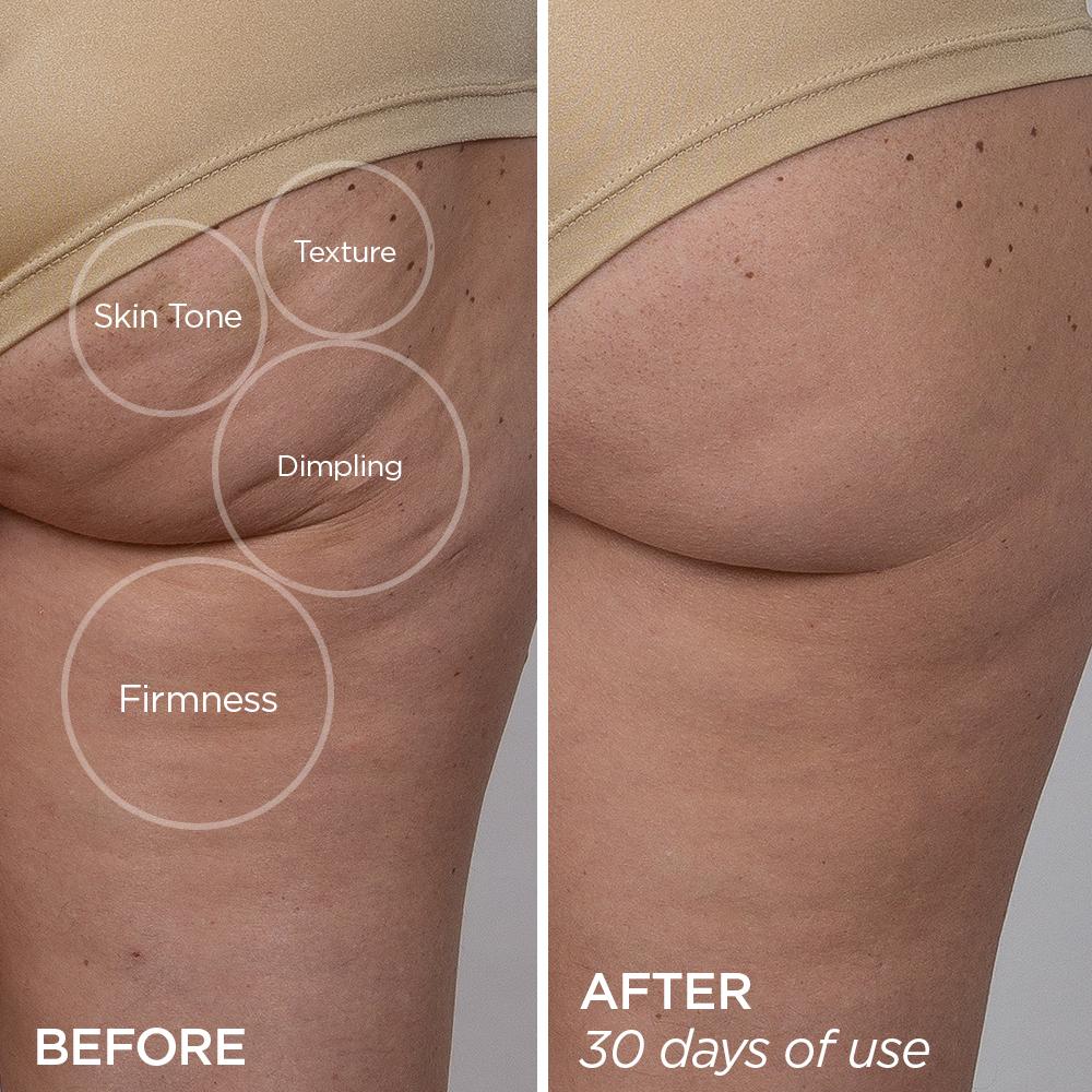 GloPRO® Meet the MicroTips™ Set Sets BeautyBio