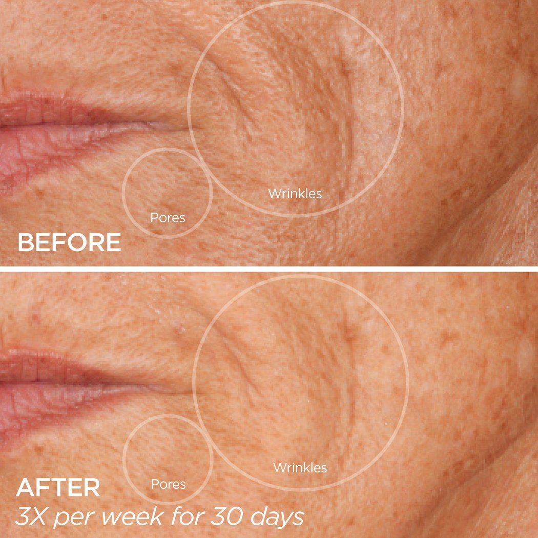 Let it GLO GloPRO BeautyBio