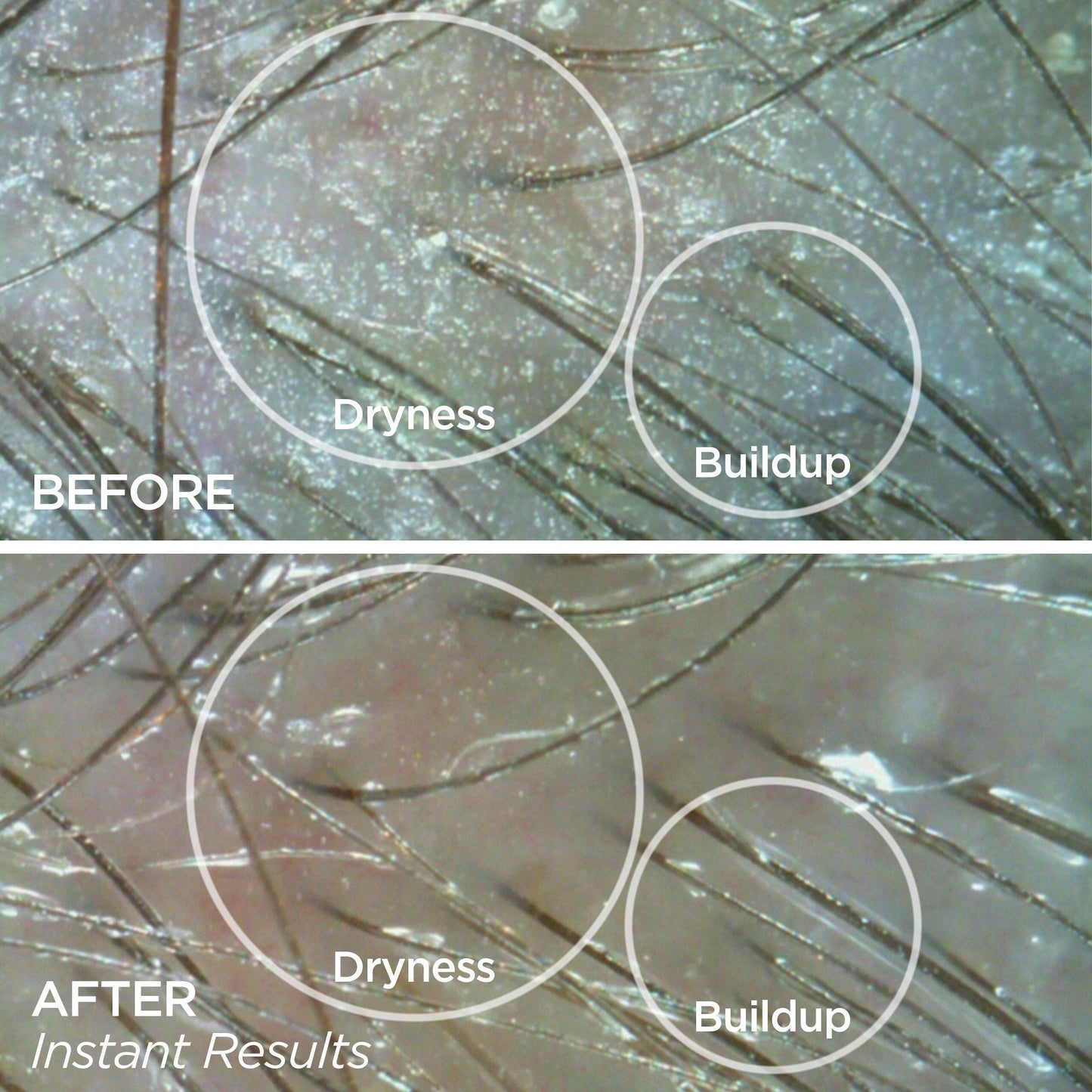 BeautyBio Men's Healthy Scalp + Beard Serum Before & Afer