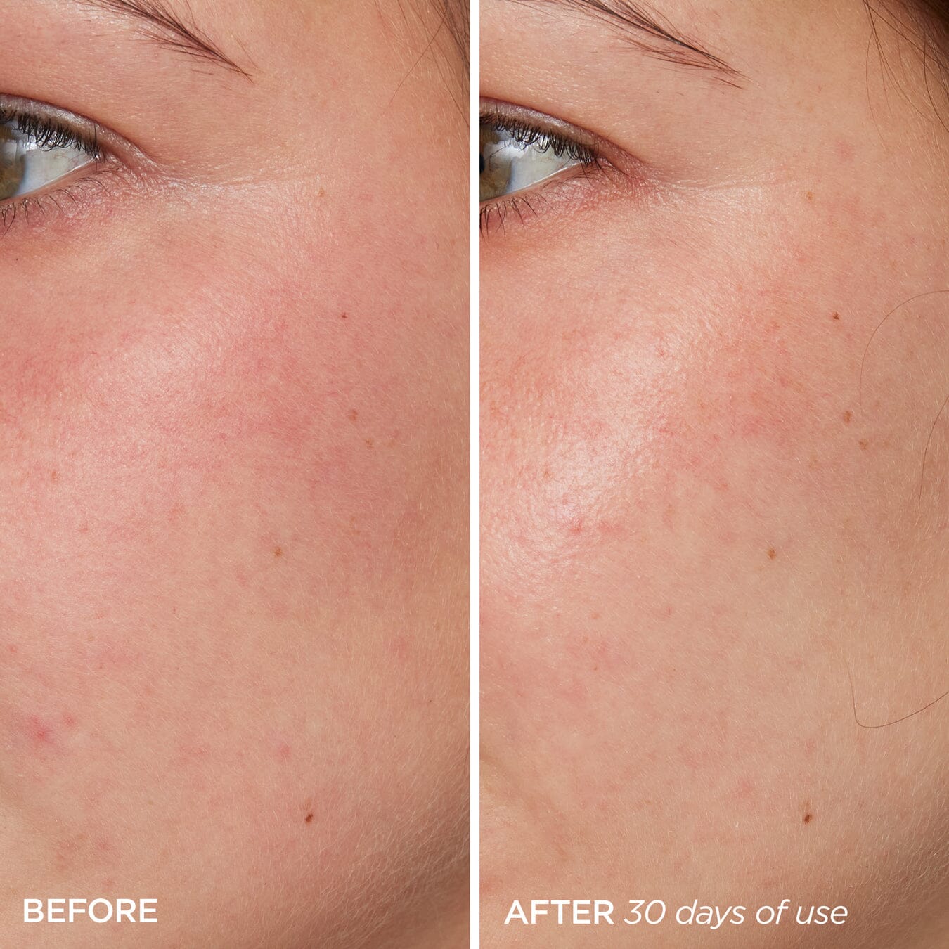 The Daily Skincare BeautyBio