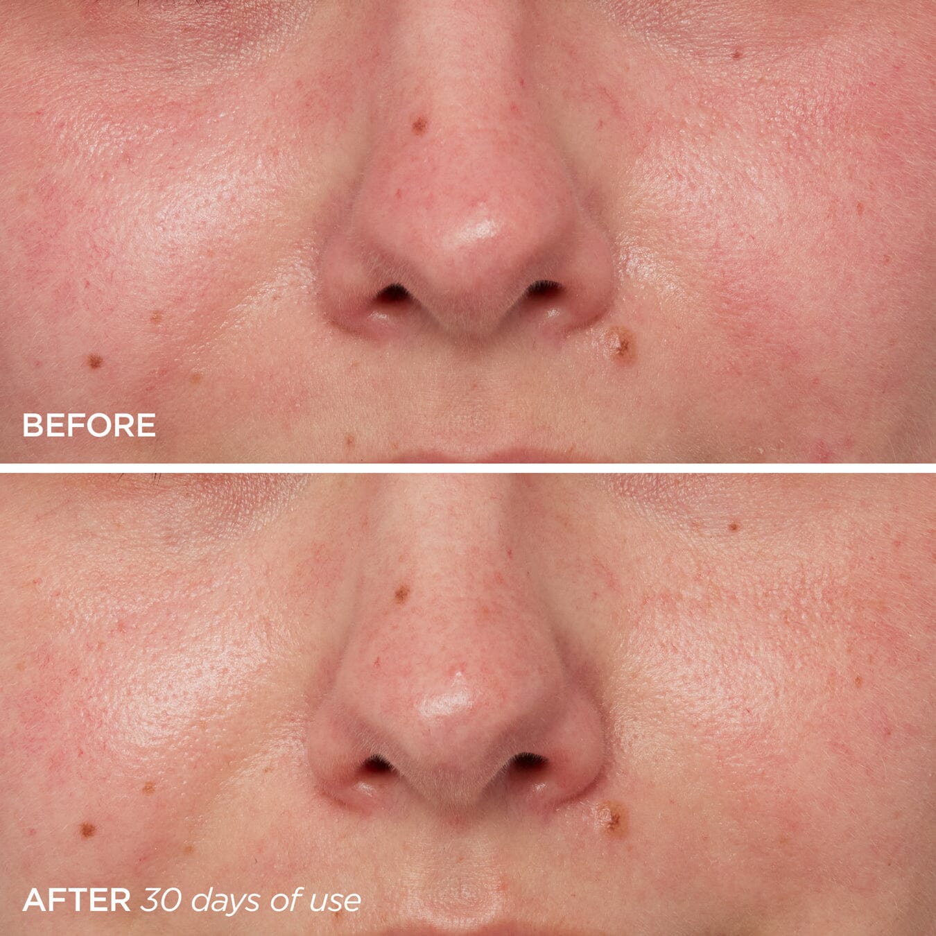The Daily Skincare BeautyBio