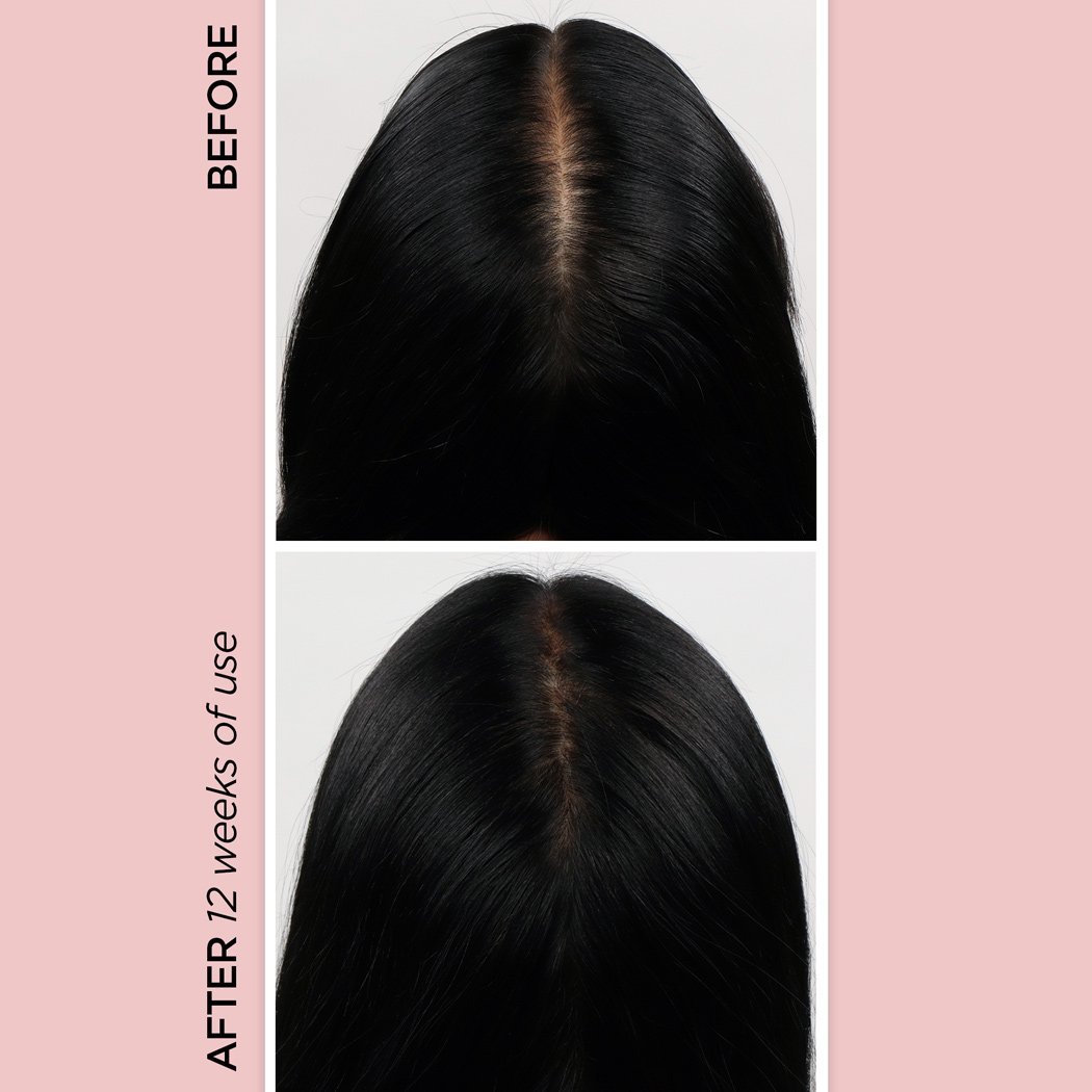 Rose Gold Rejuvenating Scalp + Fuller Hair Therapy Set + Pack N' Glo Haircare BeautyBio 