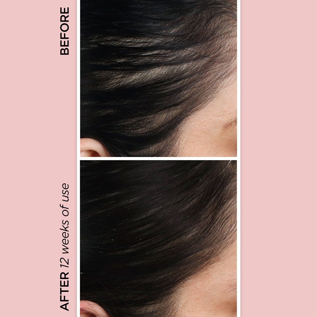 Rose Gold Rejuvenating Scalp + Fuller Hair Therapy Set + Pack N' Glo Haircare BeautyBio 