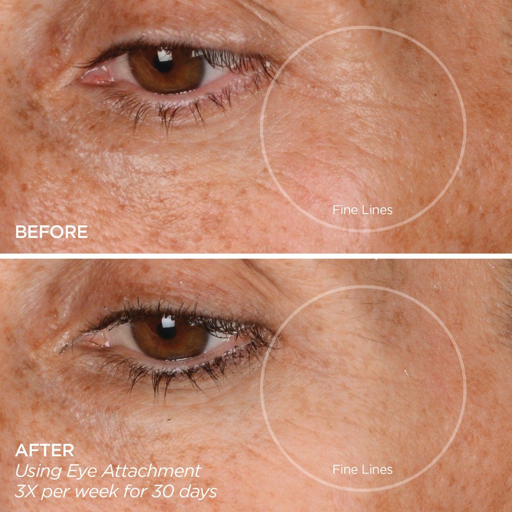 Eye Want It All Set Sets BeautyBio 