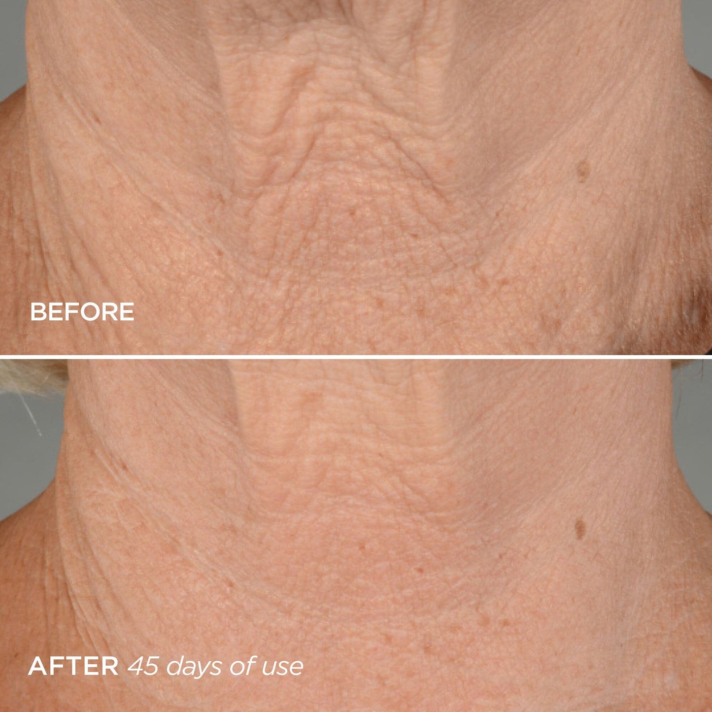 The Lift Phase 4 Neck Firming Concentrate Skincare BeautyBio 