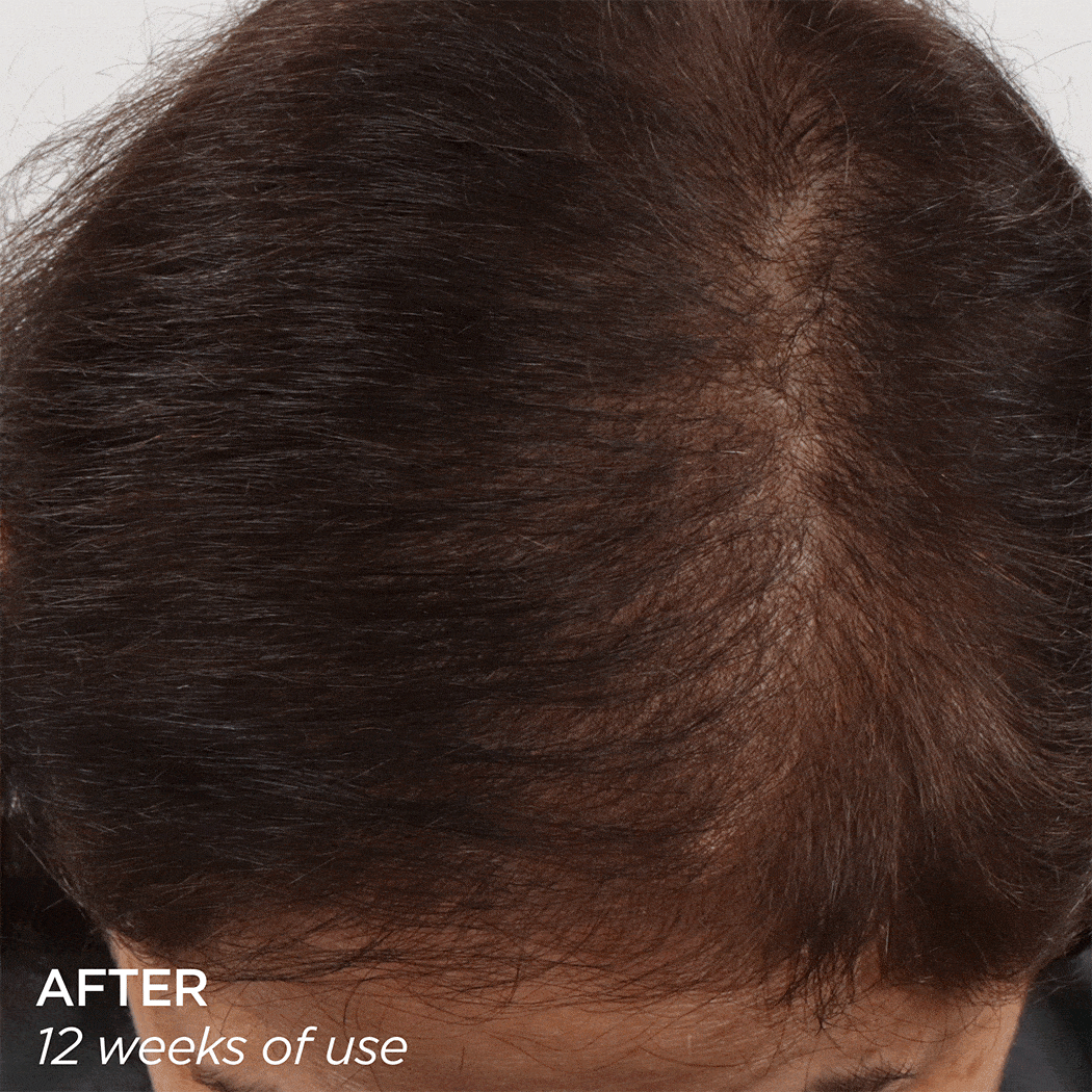 GloPRO® SCALP Attachment BeautyBio 