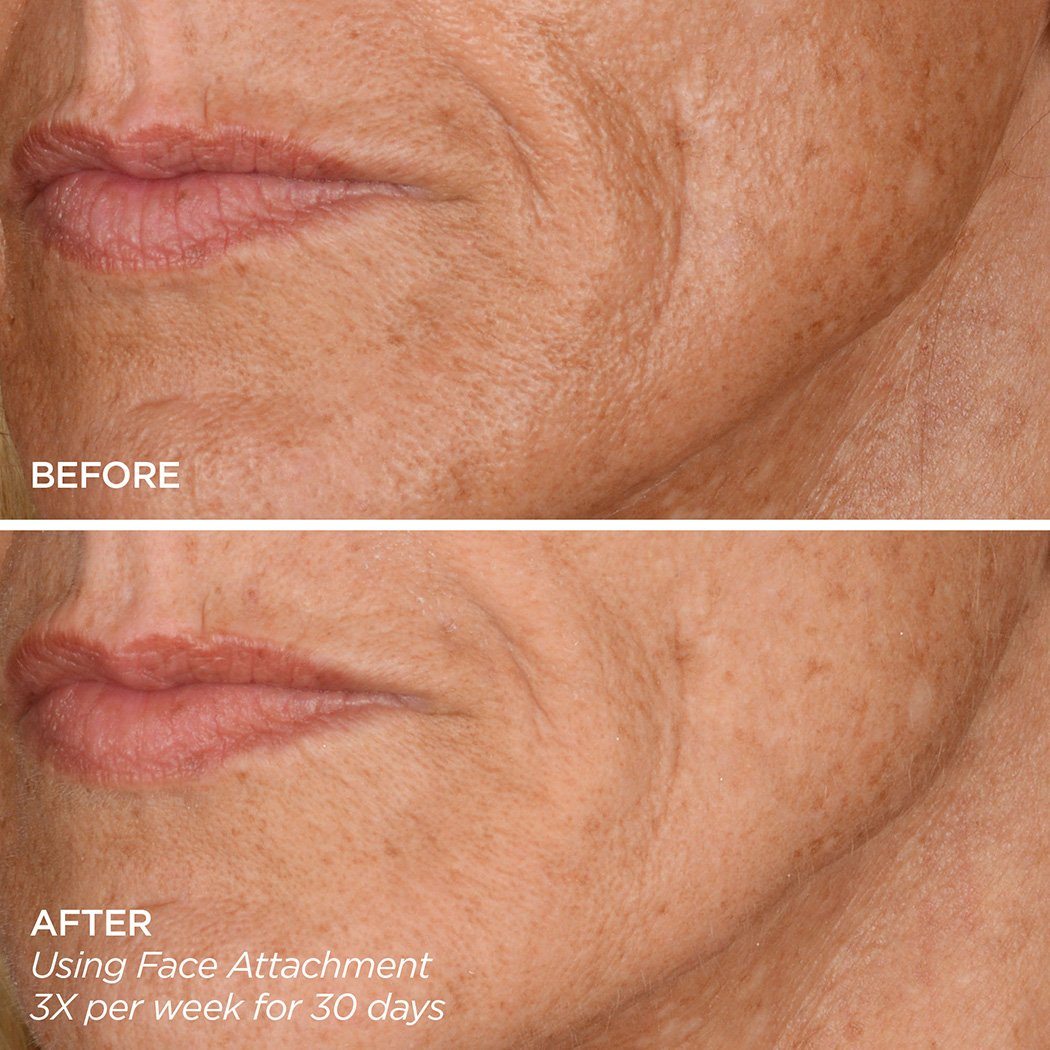 Skin That Glitters GloPRO BeautyBio 