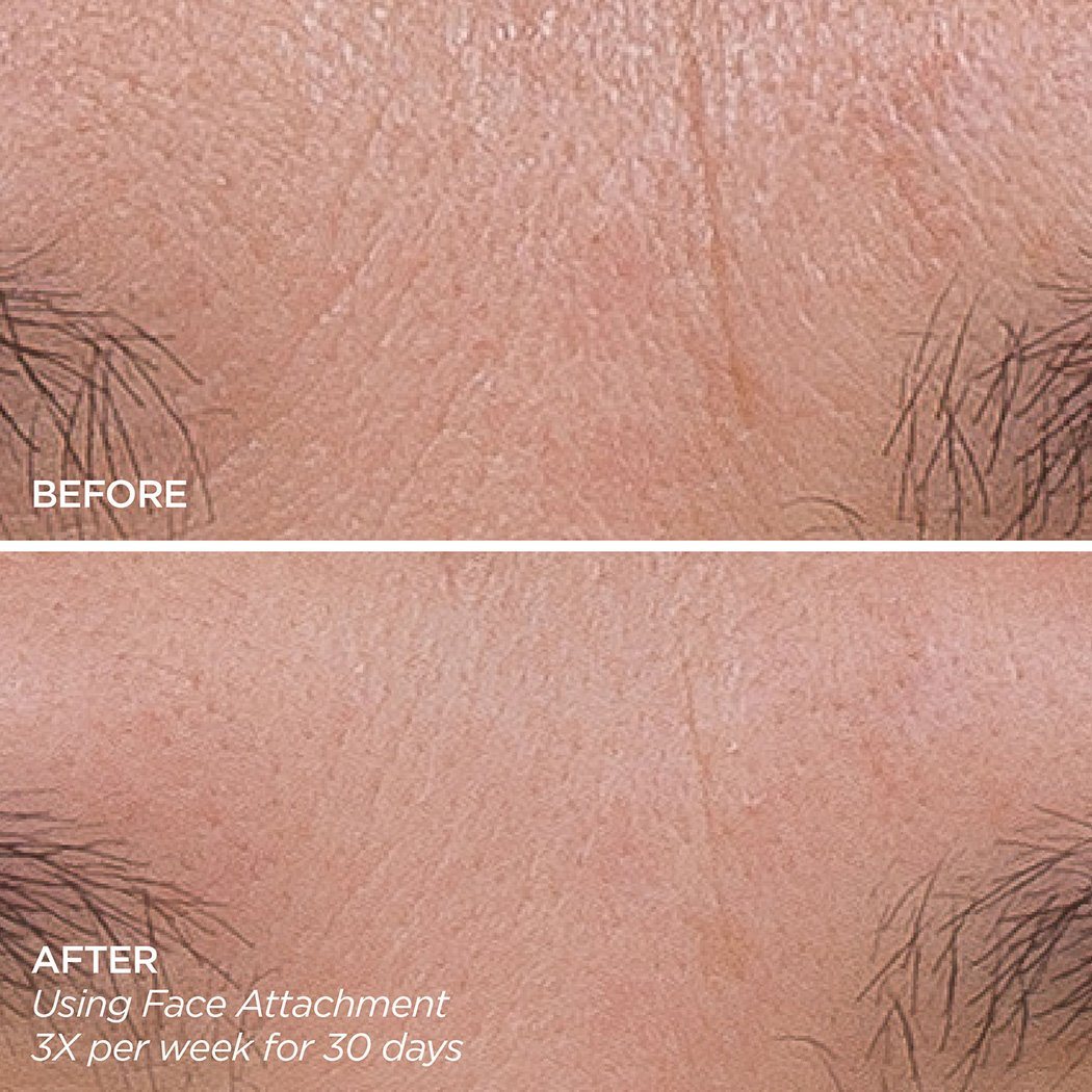 Skin That Glitters GloPRO BeautyBio 